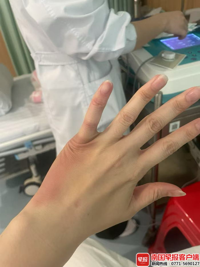 广西一女子做植发手术后，左手疼得睡不着！治疗已花费上万元